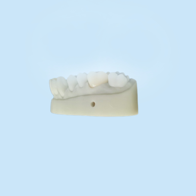 OEM 3D Printed Dental Models CAD CAM Design For Denture Laboratory