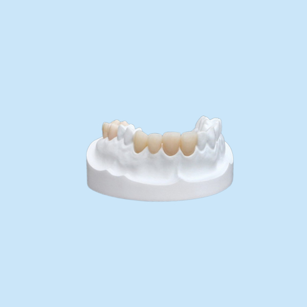 Inlays Onlays Ceramic Dental Crown Strong Veneer For Dental Department
