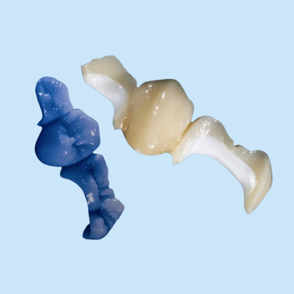 Customized OEM Polishing AllCeramic Dental Crown Veneer Inlay Onlay