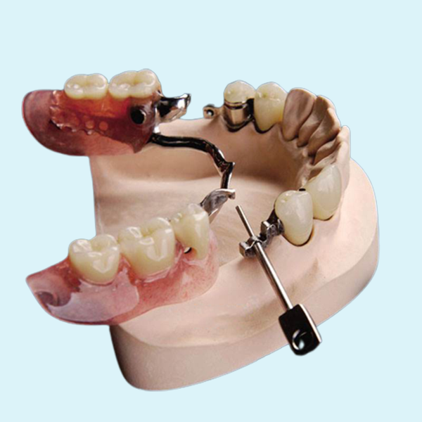 Mk1 Precision Attachment Denture Beautiful Natural Corrosion Resistant