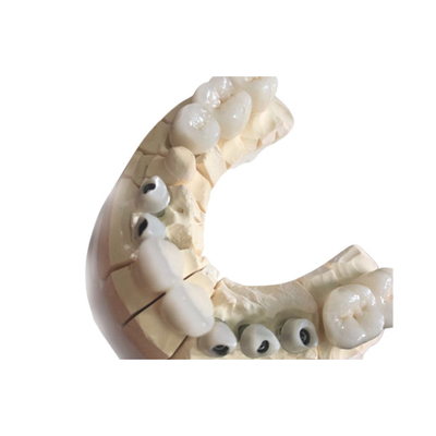 Customized Zirconia Dental Crowns Excellent Aesthetics Durable Material