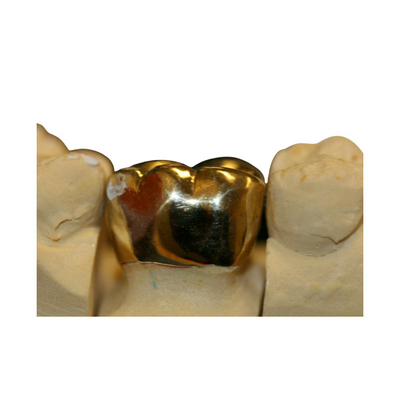 High Density Fine Protection FMC Crown Bridge Dental Laboratory