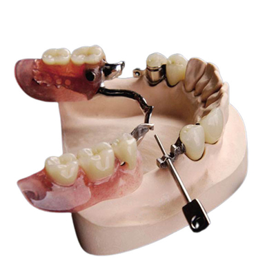 Mk1 Precision Attachment Denture Beautiful Natural Corrosion Resistant