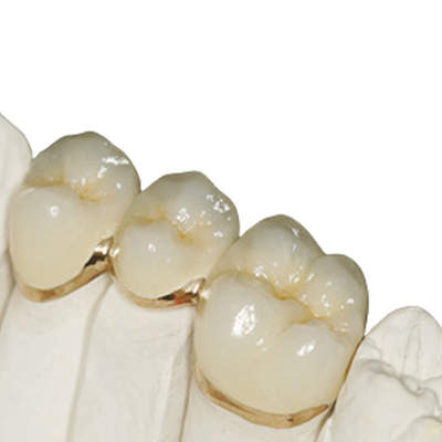 Dental Restoration Lab specializing in Zirconia Repair with Precise Fitting