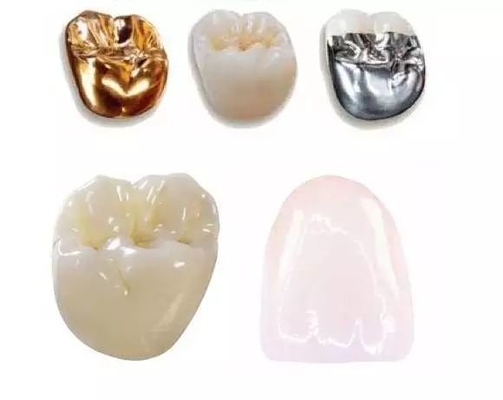 Good Biocompatibility Dental Crowns And Bridges Not Easy To Wear Color Stable