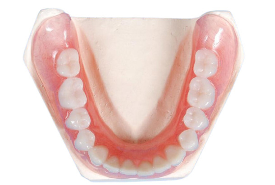 Porcelain Tooth Crown Strong Wear Resistance Color Stable High Quality