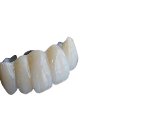 Realistic Appearance Bridges And Dental Crowns Strong Stability Natural Color