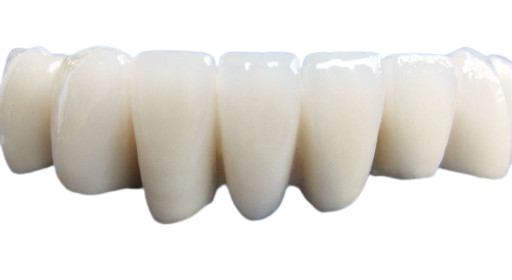 Porcelain Dental Crown Realistic Appearance Confident And Beautiful Color Stable