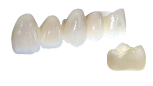 Customized Porcelain Crowns Have A Real Appearance And Natural Color