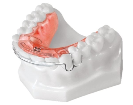 Dental Orthodontic Appliances Simple Install HighTech Biological Material