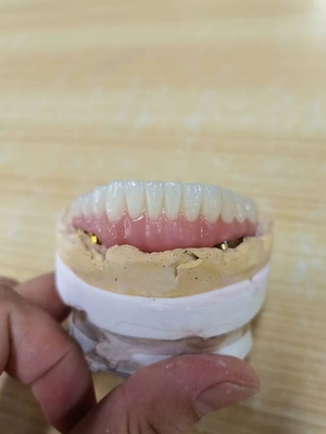 Elevating Standards Our Dental Implant Crown Quality Assurance