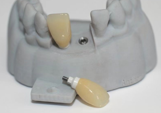 CAD PEEK custom abutment