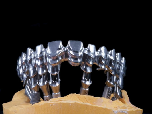 FDA 3014652903 PFM bridge dental Highly Aesthetic Extremely Strong