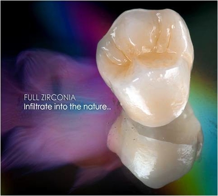 All-Ceramic FDA 3014652903 Zirconia Dental Crown Veneer Inlay Onlay