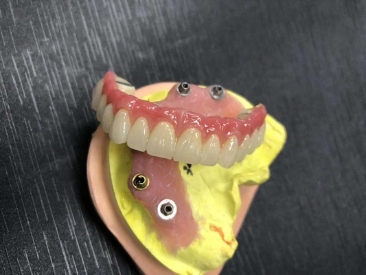 FDA 3014652903 PFM bridge dental Highly Aesthetic Extremely Strong