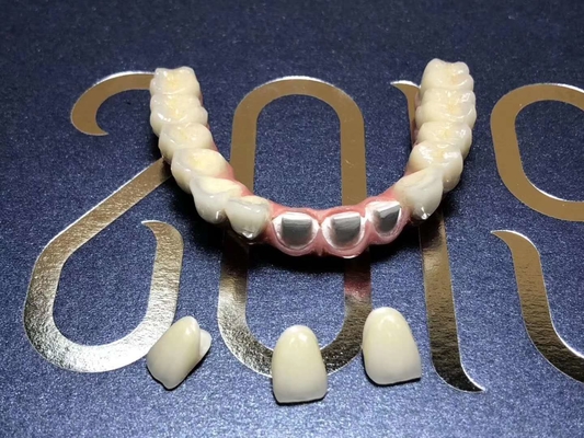 Smooth Surface Biocompatible Zirconia Tooth Crown Easy Maintain
