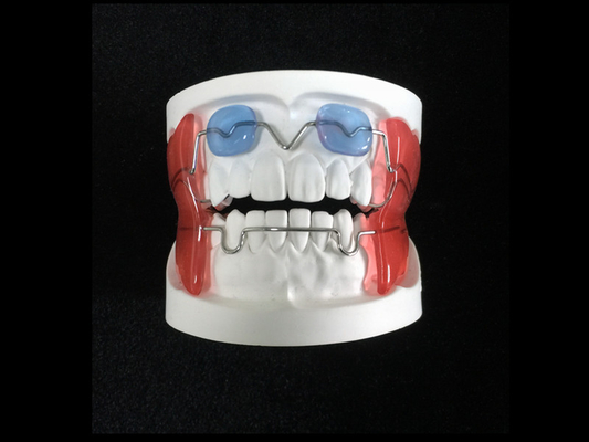 Fixed Appliance Dental Functional Appliance Good Fixation Adequate Anchorage