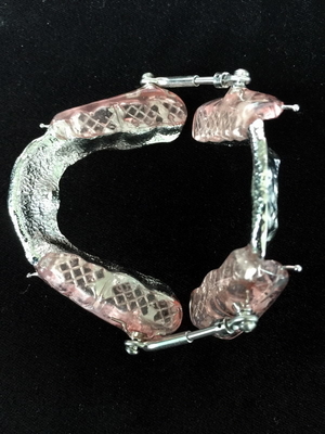 Fixed Appliance Dental Functional Appliance Good Fixation Adequate Anchorage