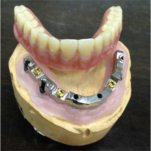 High Biological Inter Miscibility Denture Dental Lab Safety Implant