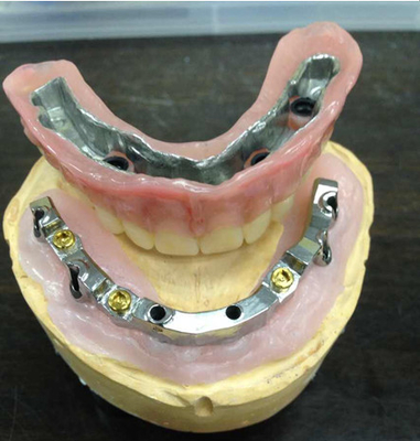 High Biological Inter Miscibility Denture Dental Lab Safety Implant