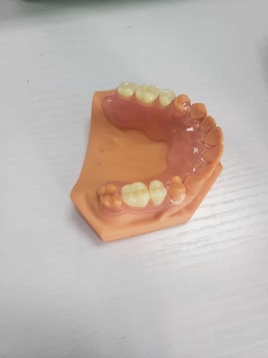 3D Printed Dentures For Dental Labs Based On Digital Data