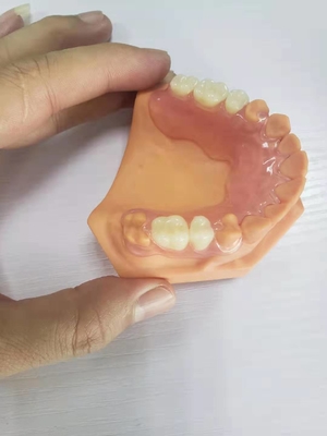 3D Printed Dentures For Dental Labs Based On Digital Data