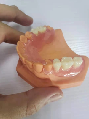 3D Printed Dentures For Dental Labs Based On Digital Data