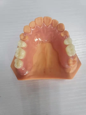 3D Printed Dentures For Dental Labs Based On Digital Data