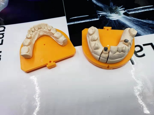 High Strength Yellow Gold Porcelain Dental Crown PFM Ceramic Crown