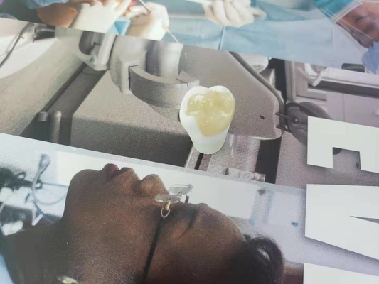 Durable FDA All-Ceramic Dental Crown Veneer Inlay Onlay Similar
