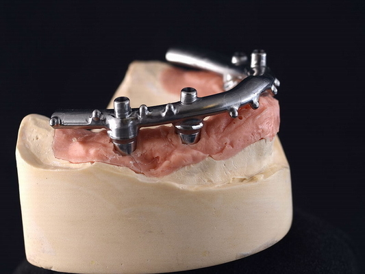 All-On-4 Titanium CNC Implant Secured Dentures For Dental Clinic