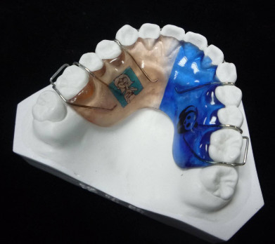High Durability Adjustable Fixing Orthodontic Appliance Wire
