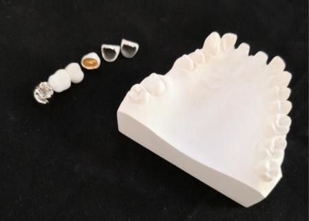 Customized PFM Porcelain Dental Crown Full Metal Corrosion Resistance