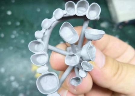 Customized PFM Porcelain Dental Crown Full Metal Corrosion Resistance