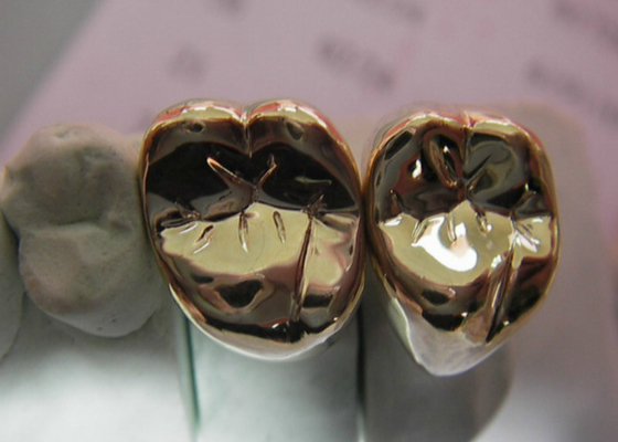 High Stability Semi Precious Dental Crown Bridge PFM Easy Casting