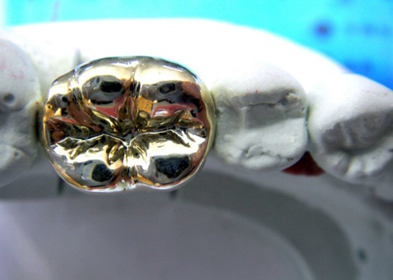 High Stability Semi Precious Dental Crown Bridge PFM Easy Casting