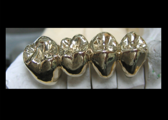 High Stability Semi Precious Dental Crown Bridge PFM Easy Casting