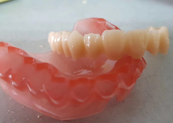 Realistic Digital Data OEM 3D Printed Dental Models For Dentist Study