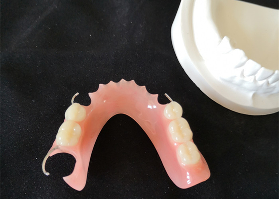 High Definition PFM Bridge Dental Colour Stability Smooth Surface