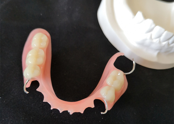 High Definition PFM Bridge Dental Colour Stability Smooth Surface