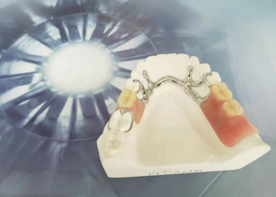 Cocr Chrome Cast Removable Dental Crown Easy Clean Strong Hardness