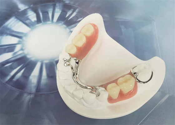 Cocr Chrome Cast Removable Dental Crown Easy Clean Strong Hardness