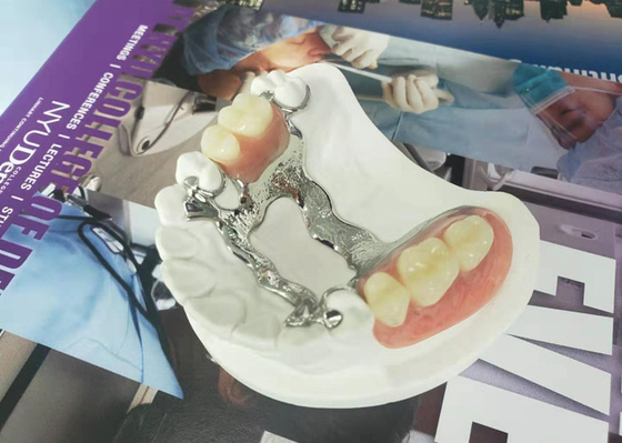 Natrural Shade 3D Printing Fixed Removable Denture For Dentist Study