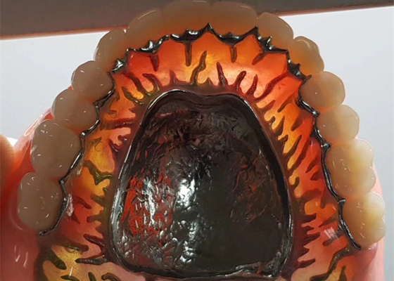 High-Intensity Safety OEM Removable Dental Crown For Dentist Study