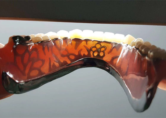 High-Intensity Safety OEM Removable Dental Crown For Dentist Study