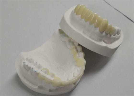 High Durability CAD CAM 3D Printing Temporary Crowns Durable Resin