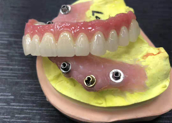 Implant Abutment Zirconia Dental Crown Natural All On Four Dentures