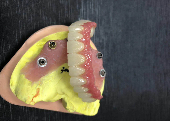 Implant Abutment Zirconia Dental Crown Natural All On Four Dentures