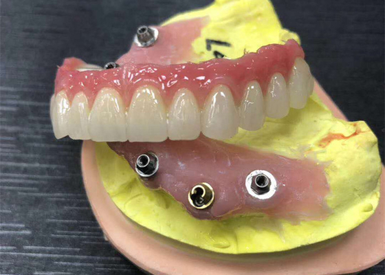 Implant Abutment Zirconia Dental Crown Natural All On Four Dentures