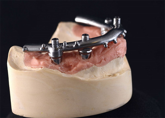 High-Density PFM Dental Implants Dentures Strong Hardness Long Lasting​